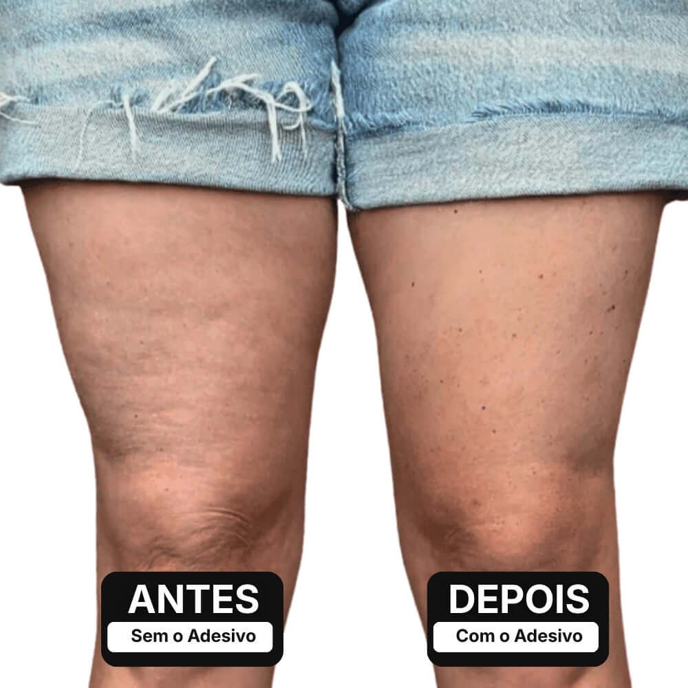 Adesivo Modelador Invisível para Pernas – ClearLift™ [COMPRE 1 LEVE 2]