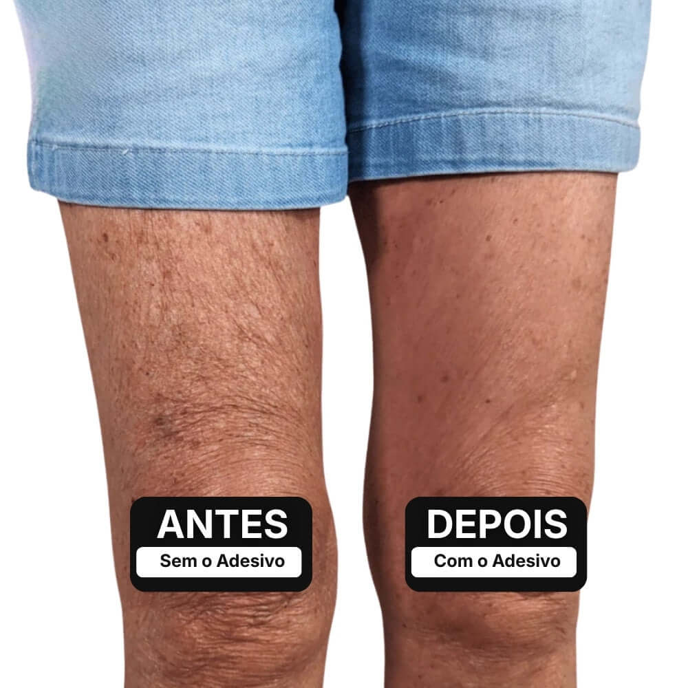 Adesivo Modelador Invisível para Pernas – ClearLift™ [COMPRE 1 LEVE 2]