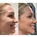 Massageador Facial Rejuvenescedor com Fototerapia LED