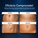 Creme Anti-Estrias Cicatribem – Hidratação Profunda + Regeneração da Pele
