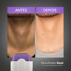 Depilador Facial e Corporal Sem Dor - Recarregável