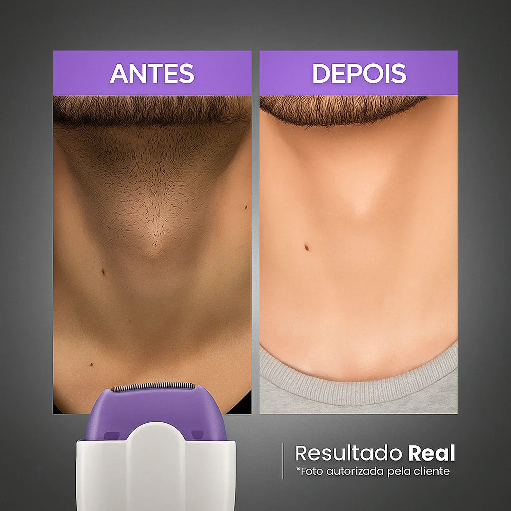 Depilador Facial e Corporal Sem Dor - Recarregável
