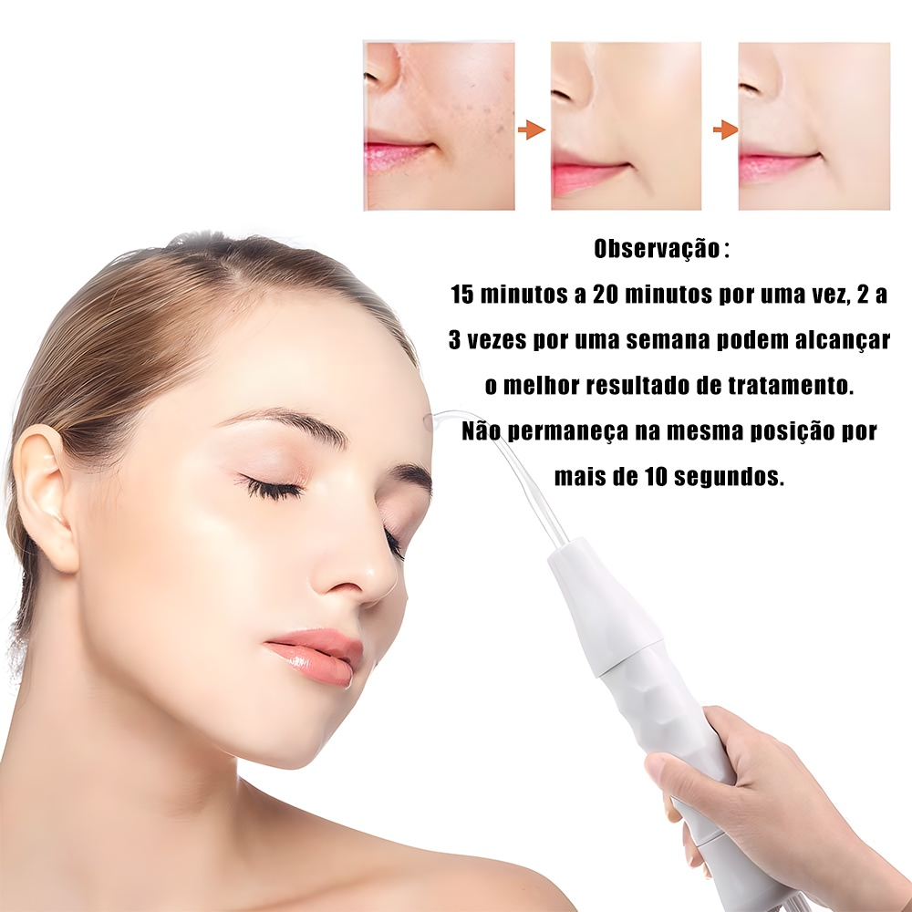 Aparelho Alta Frequência Portátil Ozônio Tratamento de Pele Facial e Capilar Removedor de Acne Cravos 4 ou 5 Eletrodos