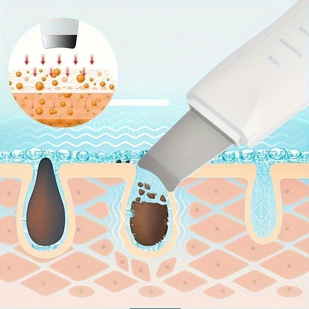 Aparelho de Peeling Ultrassônico Facial 3 em 1 – PureLift SkinWave