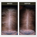 Escova Massagem Capilar com Aplicador de couro cabeludo Elétrico Luz vermelha