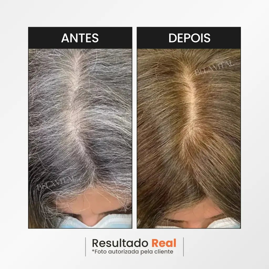 Shampoo Escurecedor Natural 3 em 1 Anti Queda e Reparador Capilar (Até 6 Meses) + Brinde