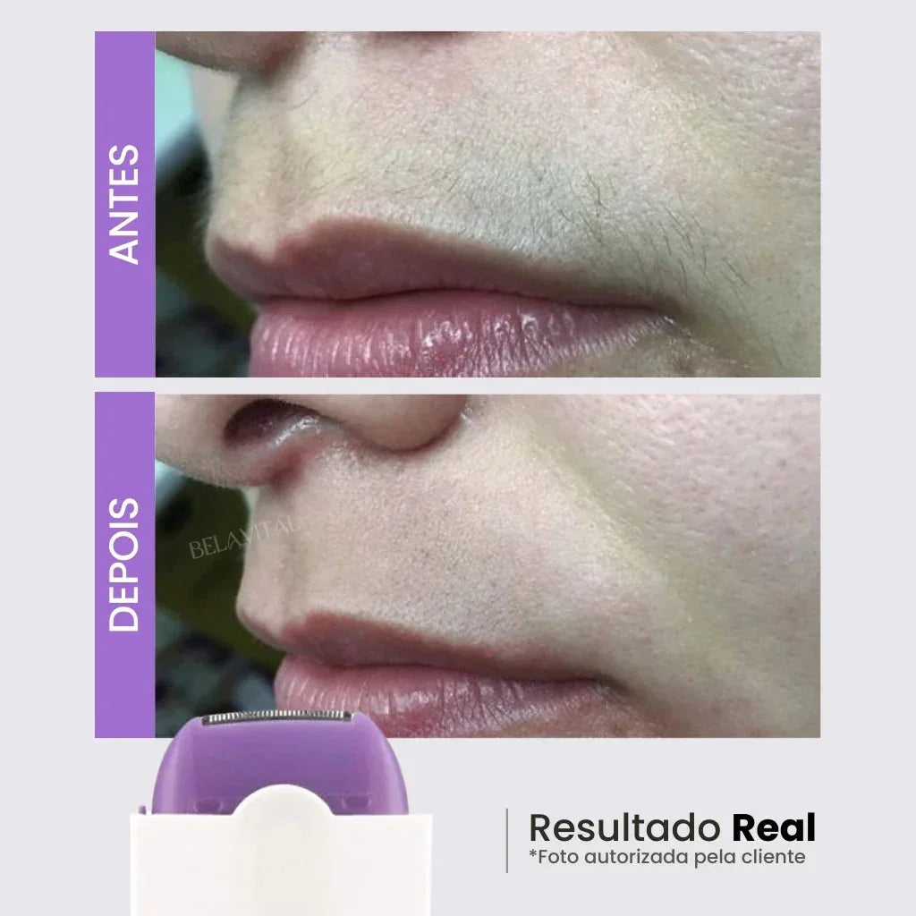 Depilador Facial e Corporal Sem Dor - Recarregável