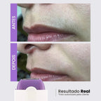 Depilador Facial e Corporal Sem Dor - Recarregável