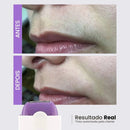 Depilador Elétrico Facial e Corporal Recarregável Sem Dor – Ideal para Homens e Mulheres | Modernara