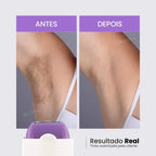 Depilador Facial e Corporal Sem Dor - Recarregável