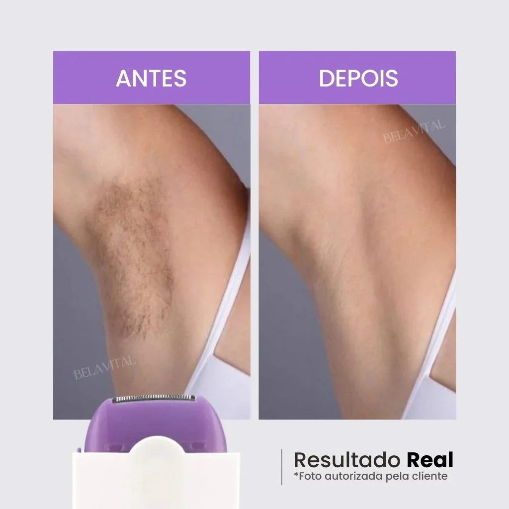 Depilador Facial e Corporal Sem Dor - Recarregável